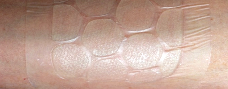HHH - Hydrocolloid Hydrogel Hybrid