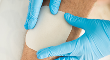 Hydrocolloid Dressings