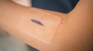 RTM_Gel Foot Care_370x202