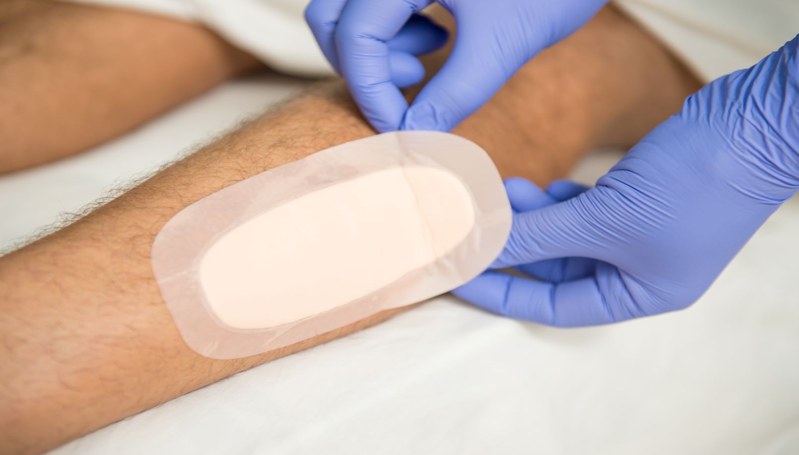 Frontiers | First-Line Interactive Wound Dressing Update: A Comprehensive  Review of the Evidence