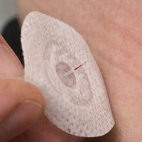 Diagnostics