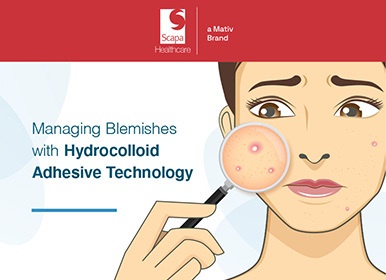 scapa-acne-infographic_website-featured-image-386x290 3