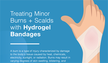 infographic infographic